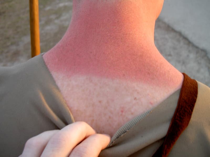 Sunscreen